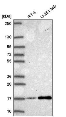 Western Blot: NEK6 Antibody [NBP2-58672] - Western blot analysis in human cell line RT-4 and human cell line U-251 MG.