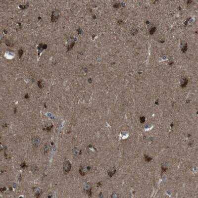 Immunohistochemistry: NEK7 Antibody [NBP1-86457] - Staining of human hippocampus shows strong cytoplasmic positivity in neuronal cells.