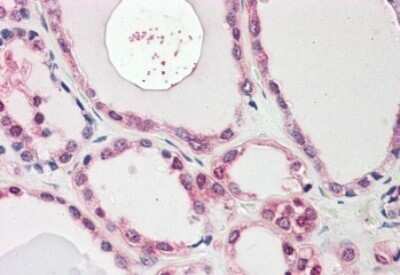 Immunohistochemistry-Paraffin: NEK7 Antibody [NBP1-52115] - 3.75ug/ml staining of paraffin embedded Human Thyroid. Steamed antigen retrieval with citrate buffer pH 6, AP-staining.