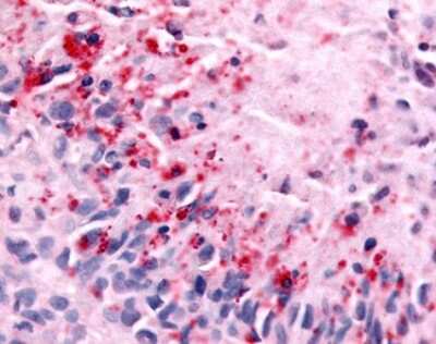 Immunohistochemistry-Paraffin: NEK7 Antibody [NLS7164] - Analysis of anti-NEK7 antibody with human brain, glioblastoma.