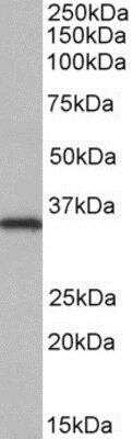 Western Blot: NEK7 Antibody [NBP1-52115] - (0.05ug/ml) staining of HeLa lysate (35ug protein in RIPA buffer). Primary incubation was 1 hour. Detected by chemiluminescence.