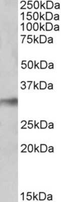 Western Blot: NEK7 Antibody [NBP1-68866] - NBP1-68866 (0.1ug/ml) staining of Human Lung lysate (35ug protein in RIPA buffer). Primary incubation was 1 hour. Detected by chemiluminescence.