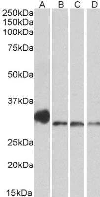 Western Blot: NEK7 Antibody [NBP1-68866] - Analysis of Mouse Lung (A), Mouse Testis (B), Rat Lung (C) and Rat Testis (D) lysates (35 ug protein in RIPA buffer). Primary incubation was 1 hour. Detected by chemiluminescence.