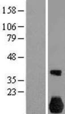 Western Blot: NEK7 Overexpression Lysate (Adult Normal) [NBL1-13587] Left-Empty vector transfected control cell lysate (HEK293 cell lysate); Right -Over-expression Lysate for NEK7.