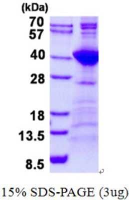 SDS-Page: Recombinant Human NEK7 Protein [NBP2-23287]