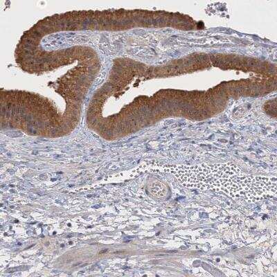 Immunohistochemistry-Paraffin NEK8 Antibody