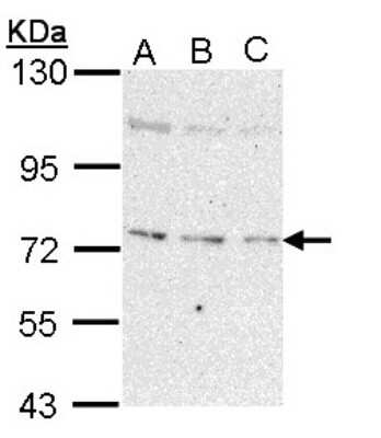 Western Blot: NEK8 Antibody [NBP1-33331] - Sample (30 ug of whole cell lysate) A: 293T B: A431 C: H1299 7. 5% SDS PAGE; antibody diluted at 1:1000.