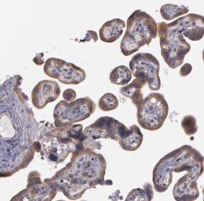 Immunohistochemistry-Paraffin: NEK9 Antibody [NBP1-88007] -  Staining of human placenta shows weak to moderate cytoplasmic positivity in trophoblastic cells.