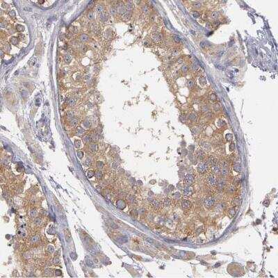 Immunohistochemistry-Paraffin: NEK9 Antibody [NBP1-88007] -  Staining of human testis shows moderate cytoplasmic positivity in cells in seminiferous ducts.