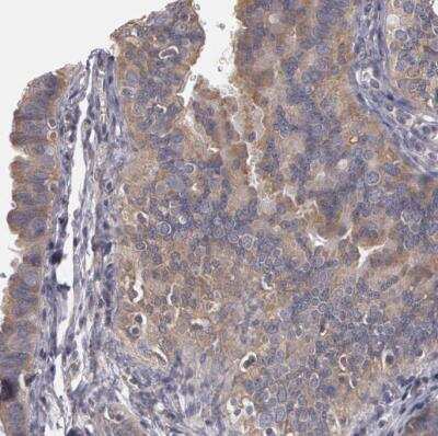 Immunohistochemistry-Paraffin: NEK9 Antibody [NBP1-88007] - Staining of human fallopian tube shows weak to moderate cytoplasmic positivity in glandular cells.