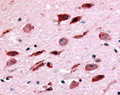 Immunohistochemistry-Paraffin: NEK9 Antibody [NBP2-31091] - IHC analysis of Brain using NBP2-31091 at 4 ug/ ml.