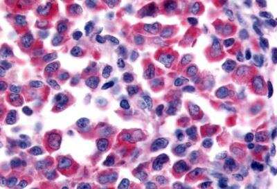 Immunohistochemistry-Paraffin: NEK9 Antibody [NBP2-31091] - Non-Hodgkin's lymphoma. 