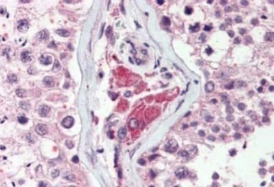 Immunohistochemistry-Paraffin: NEK9 Antibody [NBP3-14416] - Immunohistochemistry of formalin-fixed, paraffin-embedded human testis after heat-induced antigen retrieval.