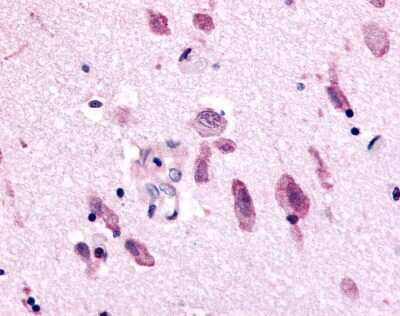 Immunohistochemistry-Paraffin: NEK9 Antibody [NLS7967] - Analysis of anti-NEK9 antibody with human brain at 3.6 ug/ml.