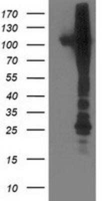 Western Blot: NEK9 Antibody (OTI1H1) - Azide and BSA Free [NBP2-72939] - HEK293T cells were transfected with the pCMV6-ENTRY control (Left lane) or pCMV6-ENTRY NEK9 (Right lane) cDNA for 48 hrs and lysed. Equivalent amounts of cell lysates (5 ug per lane) were separated by SDS-PAGE and immunoblotted with anti-NEK9.