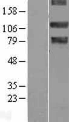 Western Blot: NEK9 Overexpression Lysate (Adult Normal) [NBL1-13588] Left-Empty vector transfected control cell lysate (HEK293 cell lysate); Right -Over-expression Lysate for NEK9.