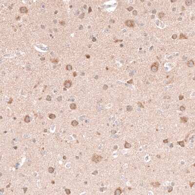 Immunohistochemistry-Paraffin: NELL1 Antibody [NBP2-13651] - Staining of human cerebral cortex shows moderate cytoplasmic positivity in neurons.