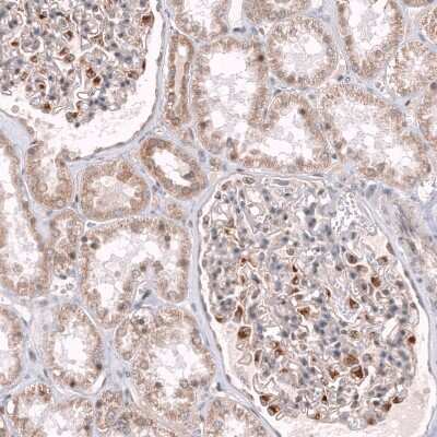 Immunohistochemistry-Paraffin: NELL1 Antibody [NBP2-13651] - Staining of human kidney shows moderate cytoplasmic positivity in a subset of cells in glomeruli.