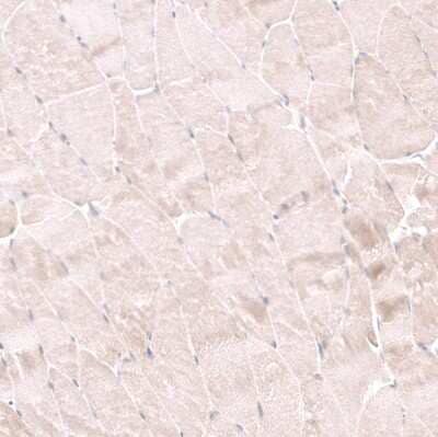 Immunohistochemistry-Paraffin: NELL1 Antibody [NBP2-13651] - Staining of human skeletal muscle shows negative to very weak positivity in myocytes.