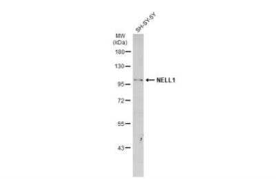 Western Blot: NELL1 Antibody [NBP2-19511] - Whole cell extract (30 ug) was separated by 7.5% SDS-PAGE, and the membrane was blotted with NELL1 antibody diluted at 1:1000. HRP-conjugated anti-rabbit IgG antibody was used to detect the primary antibody.