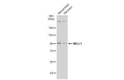 Western Blot: NELL1 Antibody [NBP2-19511] - Various tissue extracts (50 ug) were separated by 7.5% SDS-PAGE, and the membrane was blotted with NELL1 antibody diluted at 1:1000. HRP-conjugated anti-rabbit IgG antibody was used to detect the primary antibody.