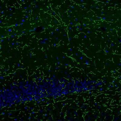 Immunohistochemistry: NET1 Antibody (CL3063) [NBP2-46648] - Staining of mouse brain shows strong positivity in noradrenergic fibers in the hippocampus.