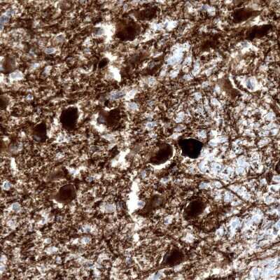 Immunohistochemistry-Paraffin: NET1 Antibody (CL3063) [NBP2-46648] - Staining of human locus coeruleus shows strong cytoplasmic positivity in noradrenaline neurons.