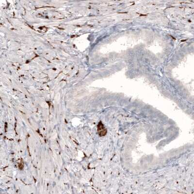 Immunohistochemistry-Paraffin: NET1 Antibody (CL3063) [NBP2-46648] - Staining of human prostate shows strong positivity in sympathetic peripheral nerves.