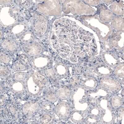 Immunohistochemistry-Paraffin: NET1 Antibody (CL3063) [NBP2-46648] - Staining of human kidney shows no positivity in cells in tubules or glomeruli as expected.