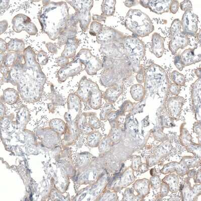 Immunohistochemistry-Paraffin: NET1 Antibody (CL3063) [NBP2-46648] - Staining of human placenta shows weak membranous positivity in trophoblastic cells.