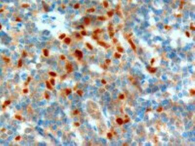 Immunohistochemistry-Paraffin: NET1 Antibody [NB100-1328] - Staining of paraffin embedded Human Tonsil. Antibody at 1 ug/mL. Microwaved antigen retrieval with citrate buffer pH 6, HRP-staining.