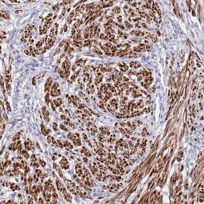 Immunohistochemistry-Paraffin: NET1 Antibody [NBP2-13653] - Staining of human smooth muscle shows strong cytoplasmic positivity in smooth muscle cells.