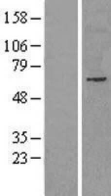 Western Blot: NET1 Overexpression Lysate (Adult Normal) [NBL1-13592] Left-Empty vector transfected control cell lysate (HEK293 cell lysate); Right -Over-expression Lysate for NET1.