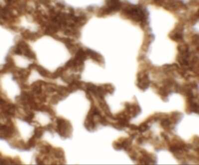 Immunohistochemistry-Paraffin: NETO1 Antibody [NBP2-41134] - Rat lung tissue with NETO1 antibody at 2.5 ug/mL.