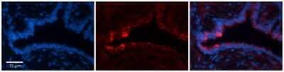 Immunohistochemistry-Paraffin: NETO2 Antibody [NBP1-62591] - Formalin Fixed Paraffin Embedded Tissue: Human Bronchial Epithelial Tissue  Observed Staining: Cytoplasmic