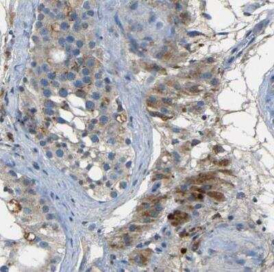 Immunohistochemistry-Paraffin NETO2 Antibody