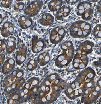 Immunohistochemistry-Paraffin NETO2 Antibody