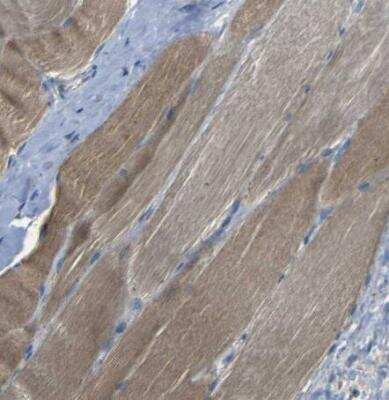 Immunohistochemistry-Paraffin: NETO2 Antibody [NBP1-84624] - Staining of human skeletal muscle shows moderate cytoplasmic positivity in myoctes.