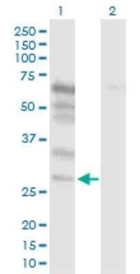 Western Blot: NETO2 Antibody [H00081831-D01P] - Analysis of NETO2 expression in transfected 293T cell line by NETO2 polyclonal antibody.Lane 1: NETO2 transfected lysate(17.00 KDa).Lane 2: Non-transfected lysate.