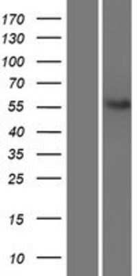 Western Blot: NETO2 Overexpression Lysate (Adult Normal) [NBL1-13593] Left-Empty vector transfected control cell lysate (HEK293 cell lysate); Right -Over-expression Lysate for NETO2.