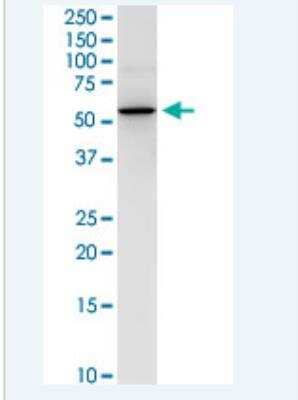 Western Blot: NEU-1/Sialidase-1 Antibody (3F9) [H00004758-M01-100ug] - NEU1 monoclonal antibody (M01), clone 3F9. Western Blot analysis of NEU1 expression in IMR-32.