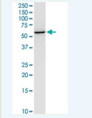 Western Blot: NEU-1/Sialidase-1 Antibody (3F9) [H00004758-M01-100ug] - NEU1 monoclonal antibody (M01), clone 3F9. Western Blot analysis of NEU1 expression in PC-12.