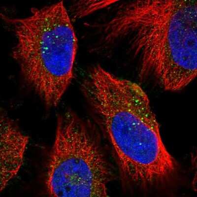 Immunocytochemistry/Immunofluorescence: NEU-1/Sialidase-1 Antibody [NBP1-87755] - Staining of human cell line U-251 MG shows localization to vesicles. Antibody staining is shown in green.