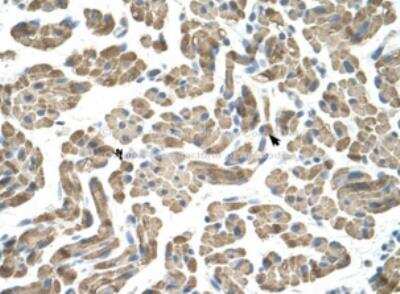 Immunohistochemistry: NEU-1/Sialidase-1 Antibody [NBP1-69387] - Human Muscle