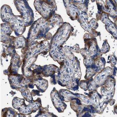 Immunohistochemistry-Paraffin: NEU-1/Sialidase-1 Antibody [NBP1-87755] - Staining of human placenta shows moderate granular cytoplasmic positivity in trophoblastic cells.