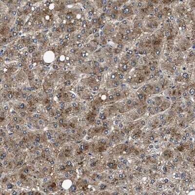 Immunohistochemistry-Paraffin: NEU-1/Sialidase-1 Antibody [NBP1-87756] - Staining of human liver shows moderate cytoplasmic positivity in hepatocytes.