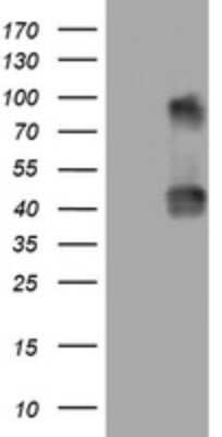 Western Blot: NEU-1/Sialidase-1 Antibody (OTI3D4) - Azide and BSA Free [NBP2-72942] - Analysis of HEK293T cells were transfected with the pCMV6-ENTRY control (Left lane) or pCMV6-ENTRY NEU1.