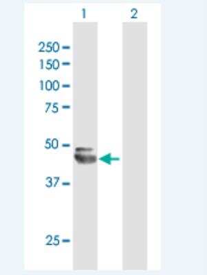 Western Blot: NEU-1/Sialidase-1 Antibody [H00004758-B02P-50ug] - Analysis of NEU1 expression in transfected 293T cell line (H00004758-T03) by NEU1 MaxPab polyclonal antibody.  Lane 1: NEU1 transfected lysate(45.65 KDa). Lane 2: Non-transfected lysate.