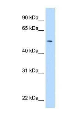 Western Blot: NEU-1/Sialidase-1 Antibody [NBP1-69387] - This Anti-NEU1 antibody was used in Western Blot of Fetal Pancreas tissue lysate at a concentration of 5ug/ml.