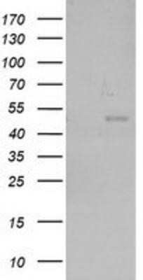 Western Blot: NEU2 Antibody (OTI4F4) - Azide and BSA Free [NBP2-72944] - HEK293T cells were transfected with the pCMV6-ENTRY control (Left lane) or pCMV6-ENTRY NEU2 (Right lane) cDNA for 48 hrs and lysed. Equivalent amounts of cell lysates (5 ug per lane) were separated by SDS-PAGE and immunoblotted with anti-NEU2.